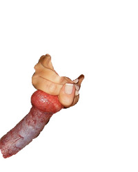 photo-thumb