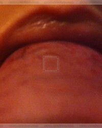 photo-thumb